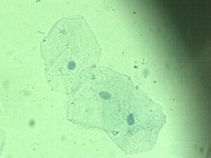 cèl·lules de la mucosa bucal