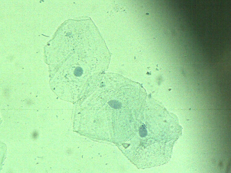 cèl·lules de la mucosa bucal